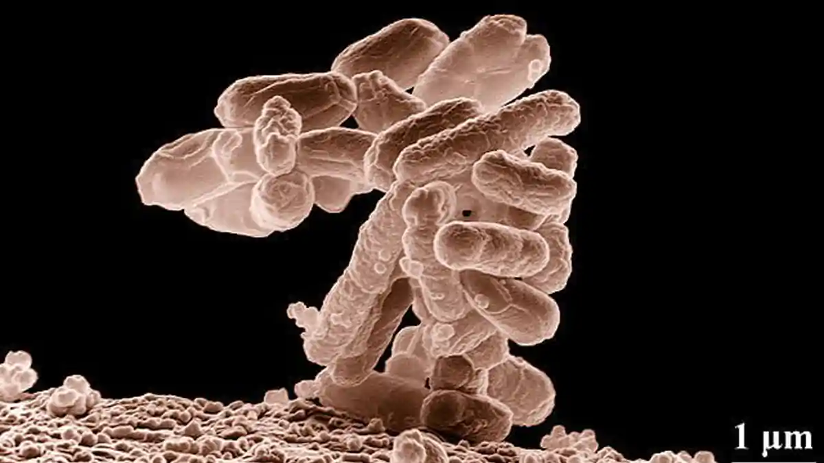 escherichia coli adalah mikroorganisme